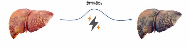齐鲁细胞马贺然博士团队第3次获批干细胞药物ind