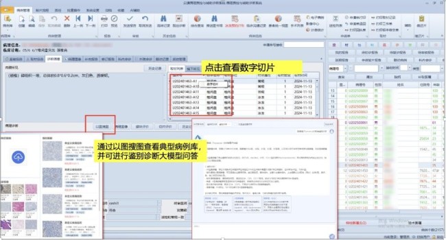 山一大一附院全面完成deepseek院级部署——“国产技术 医疗场景”“专治”各种卡脖子难题，打造医疗ai新范式
