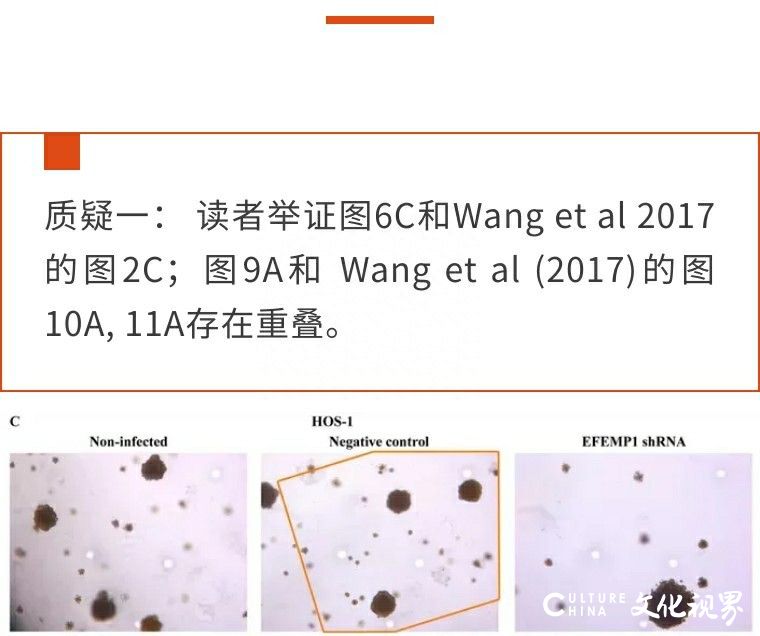 被疑大量图片与已发表文章中的图像重叠，山大齐鲁医院一论文被期刊要求撤稿