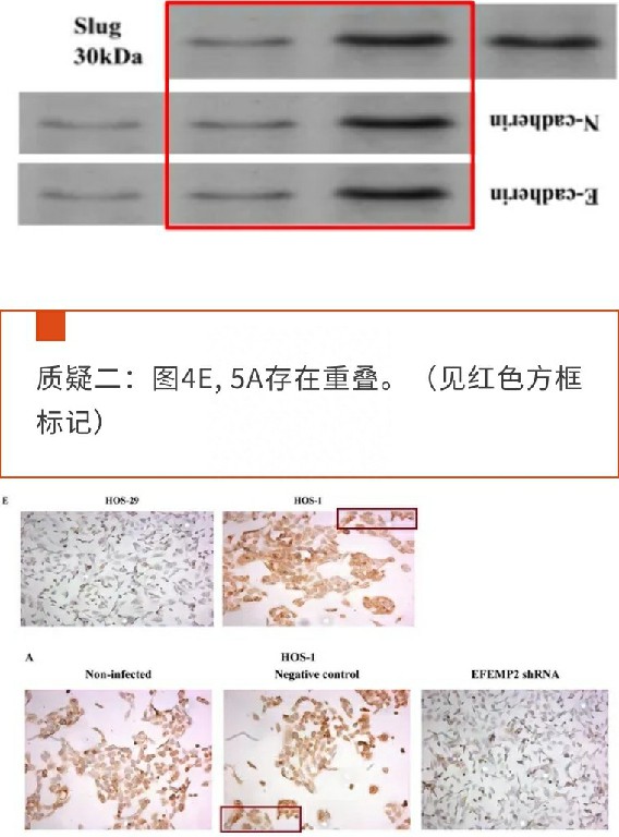 被疑大量图片与已发表文章中的图像重叠，山大齐鲁医院一论文被期刊要求撤稿